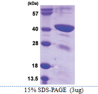 TFB1M (28-346, His-tag) Human Protein
