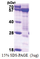 Syntrophin-1 / SNTA1 (1-505, His-tag) Human Protein