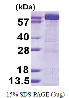GMP synthetase / GMPS (1-693, His-tag) Human Protein GMP synthetase / GMPS (1-693, His-tag) Human Protein