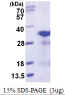 RPL8 (1-257, His-tag) Human Protein