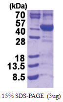 ALAD (1-330, His-tag) Human Protein