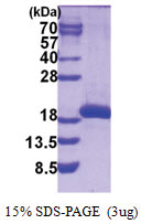 SAT2 (1-170, His-tag) Human Protein