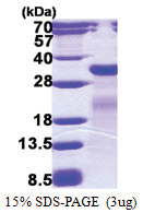 mutM (1-269, His-tag) Escherichia coli Protein