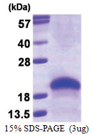 VEGF-A (207-370) Human Protein