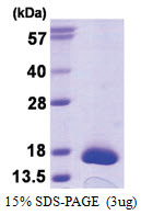 TXNDC17 / TXNL5 (1-123, His-tag) Human Protein