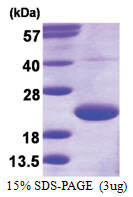 TRAPPC3 (1-180, His-tag) Human Protein