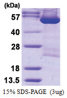 DARS1 (1-501, His-tag) Human Protein