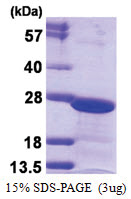 CBX3 (1-183, His-tag) Human Protein