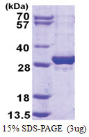 EXOSC5 (1-235, His-tag) Human Protein