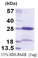 CBX5 (1-191, His-tag) Human Protein