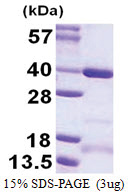 CCDC101 / SGF29 (1-293, His-tag) Human Protein