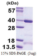 CCDC101 / SGF29 (1-293, His-tag) Human Protein