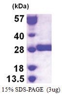 GSTM3 / GST5 (1-225, His-tag) Human Protein