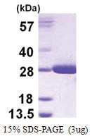 GSTT2 (1-244, His-tag) Human Protein