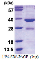 EYA2 / EAB1 (244-514, His-tag) Human Protein