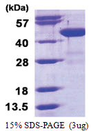 BCAT1 (1-386, His-tag) Human Protein