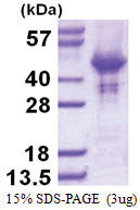 HOMER2 (1-343, His-tag) Human Protein