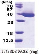 mdh (1-312, His-tag) Escherichia coli Protein