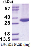 Ag85A (M. tuberculosis) / fbpA (43-338, His-tag) High Gc Gram+ Protein