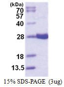 GSTA4 (1-222, His-tag) Human Protein