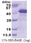 ZADH1 (1-351, His-tag) Human Protein