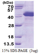 ZADH1 (1-351, His-tag) Human Protein
