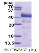 Endophilin-A1 (1-352, His-tag) Human Protein
