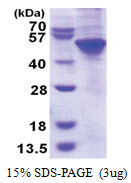 UBA5 / UBE1DC1 (1-404, His-tag) Human Protein