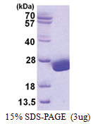 UBE2H (1-183, His-tag) Human Protein