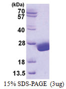 UBE2H (1-183, His-tag) Human Protein