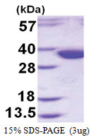 Syntaxin 2 / STX2 (1-264, His-tag) Human Protein Syntaxin 2 / STX2 (1-264, His-tag) Human Protein