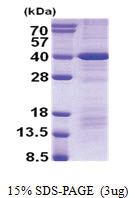 DEDD (1-318, His-tag) Human Protein DEDD (1-318, His-tag) Human Protein