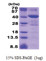 MRM1 (21-353, His-tag) Human Protein