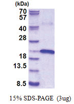 Interleukin-17B / IL17B (21-180, His-tag) Human Protein
