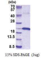 Interleukin-17B / IL17B (21-180, His-tag) Human Protein
