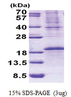 OCIAD2 (1-154, His-tag) Human Protein