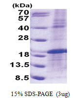 Rhombotin-1 (1-156, His-tag) Human Protein