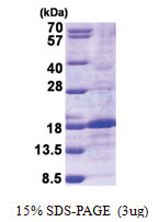 BMP6 (375-513, His-tag) Human Protein