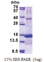 RARRES2 (21-157, His-tag) Human Protein
