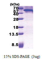 CDC123 (1-336, His-tag) Human Protein