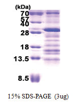 USE1 (1-231, His-tag) Human Protein