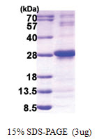 NUDT4 / DIPP2 (1-180, His-tag) Human Protein