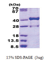 17-beta-HSD1 / HSD17B1 (1-328, His-tag) Human Protein