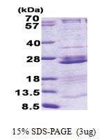RPL23A (1-156, His-tag) Human Protein
