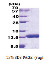 C6orf115 (1-81, His-tag) Human Protein