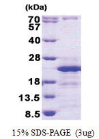 CD74 (73-232, His-tag) Human Protein