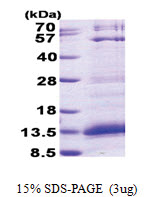 Platelet factor 4 / PF4 (32-101, His-tag) Human Protein