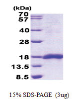 SEP15 (29-165, His-tag) Human Protein