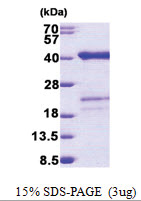 SURF2 (1-256, His-tag) Human Protein