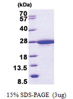 RABL5 (1-185, His-tag) Human Protein